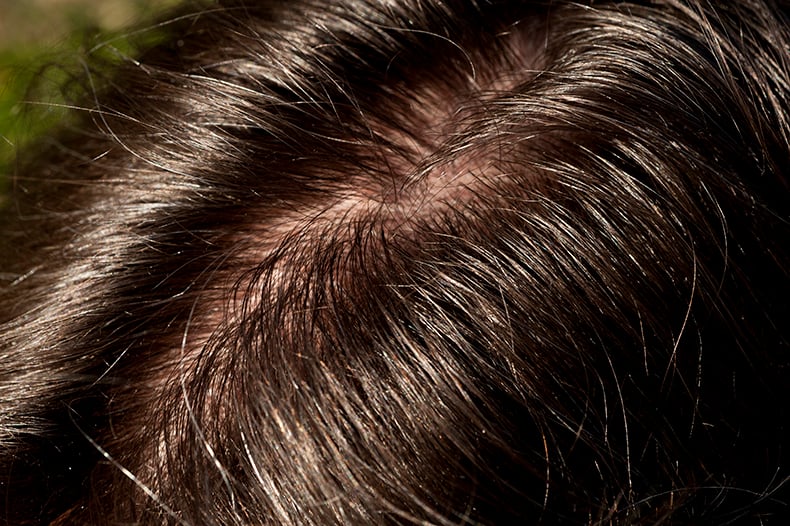 How Our Serum Formula Supports Scalp Health