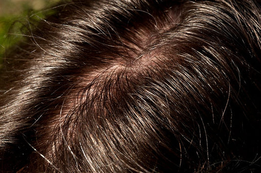 How Our Serum Formula Supports Scalp Health