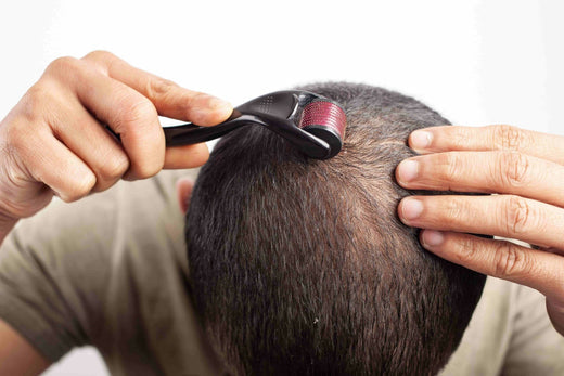 Dangers of Using a Dermaroller: Important Things to Consider Before Applying, especially on the Scalp